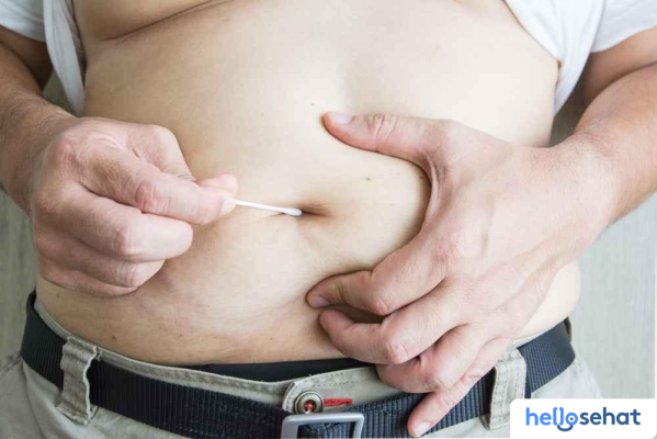 Atasi Pusar Bau: Penyebab & Solusi Ampuh Sekarang