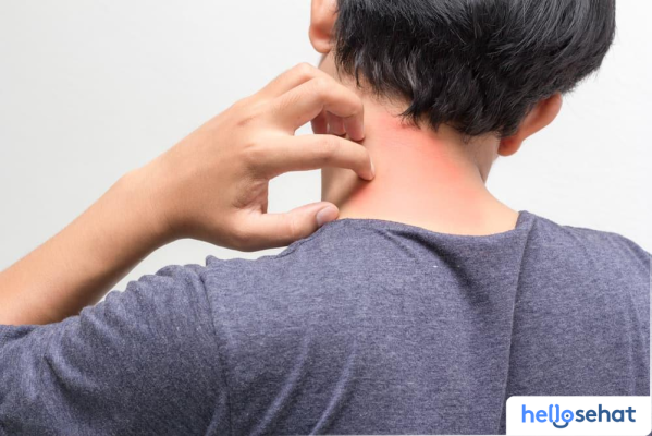 Rahasia Tubuhmu: Mengungkap Intoleransi & Alergi Alkohol